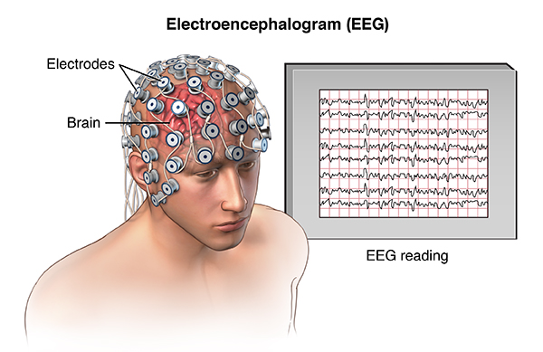 Figuur 1 - EEG