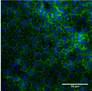 Endotheelcellen op de membranen, de cellen hebben alle typische eigenschappen van gezonde endotheelcellen met de aanwezigheid van de pompen (groen) en een zeshoekige vorm.