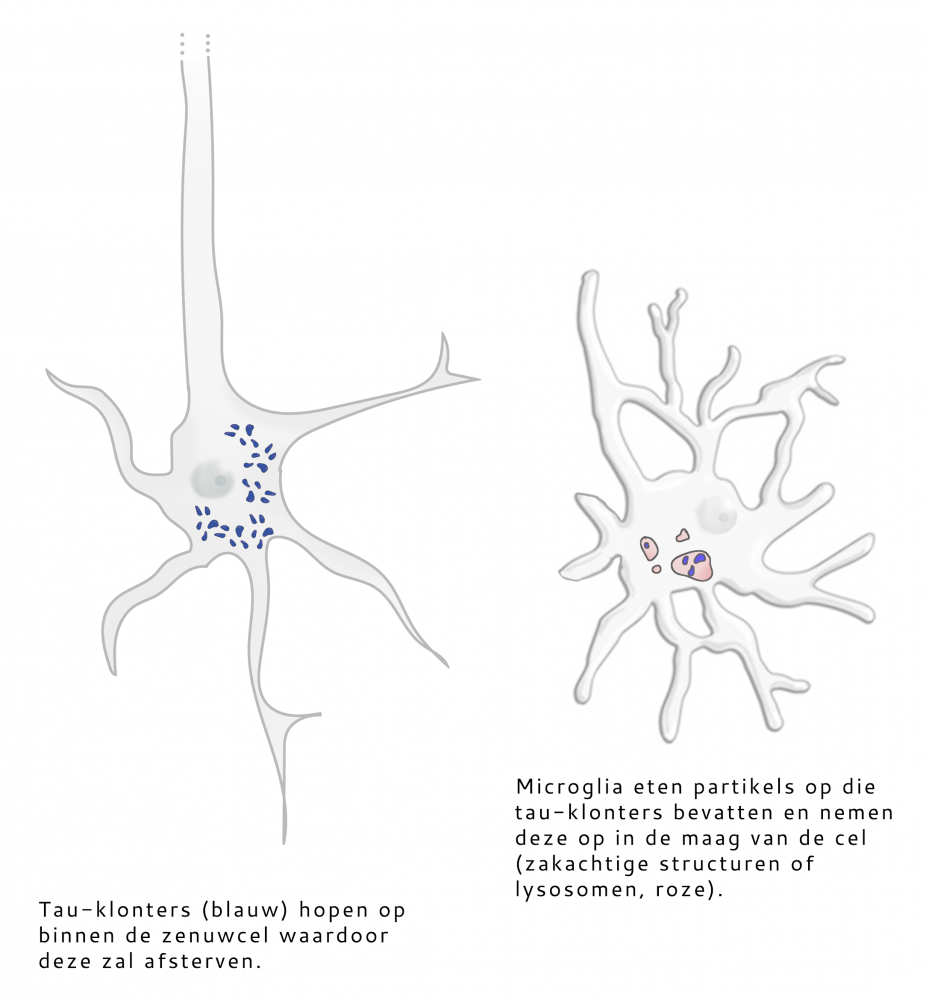 De figuur toont twee cellen. Een zenuwcel is weergegeven samen met tau-klonters die opbouwen binnenin de cel. Hiernaast is een microgliale cel weergegeven. Deze laatste bevat tau-klonters in diens maag (bestaande uit zakachtige structuren of lysosomen).