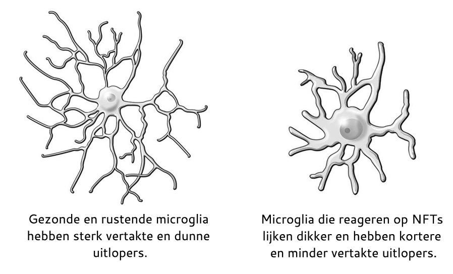 De figuur toont twee types/vormen van microglia. Gezonde/rustende microglia hebben veel dunne en sterk vertakte uitlopers. Geactiveerde microglia hebben dikkere en minder vertakte uitlopers. 