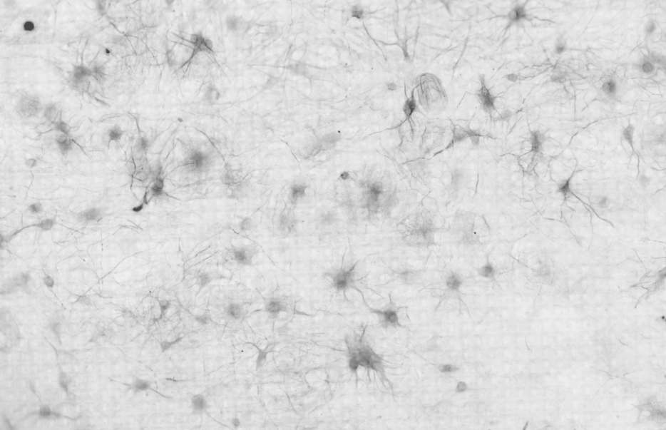 microspcopy picture of a neural netwerk cultured on top of the sensor grid