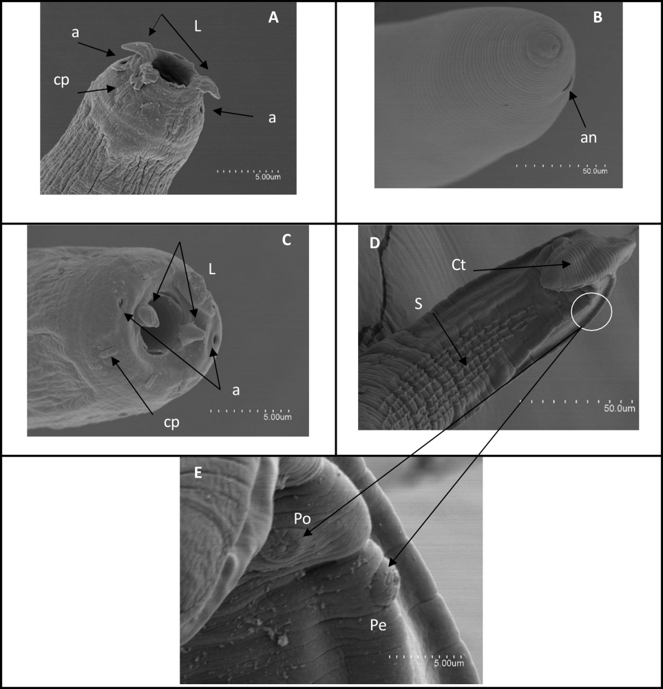 Figuur 2. SEM-beeld van een vrouwelijke en mannelijke Ascarophis filiformis. A-C Kop van een vrouwtje en mannetje (L, lippen; a, amfid; cp, cephalic papil); B. Einde van de staart van het vrouwtje met de anus (an).  D. Gebogen staart (Ct) met zuignappen (S) voor aanhechting; E. Detail beeld van de pre (pe) - en postanale papillen (po).