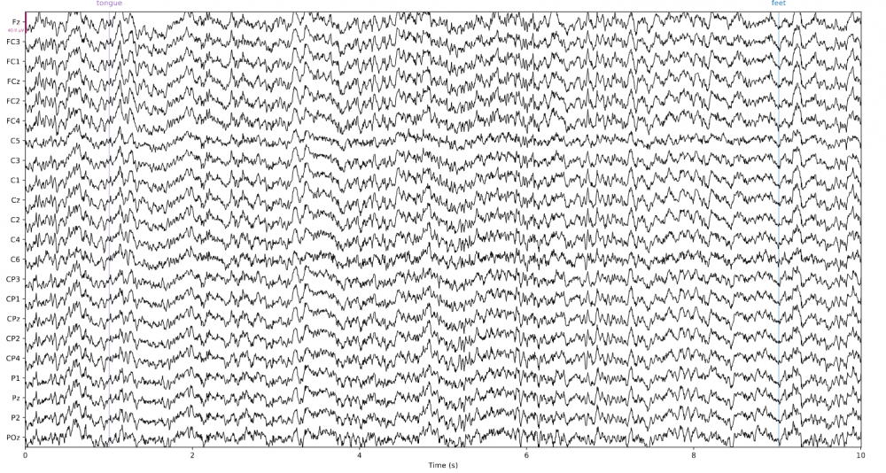 Figuur 2: Een voorbeeld EEG-opname. De horizontale as toont de tijd in seconden, de verticale as toont de EEG electroden.