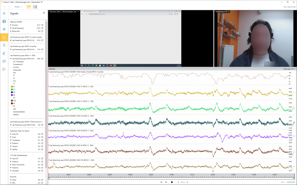 Meting van een EEG-test in analysesoftware