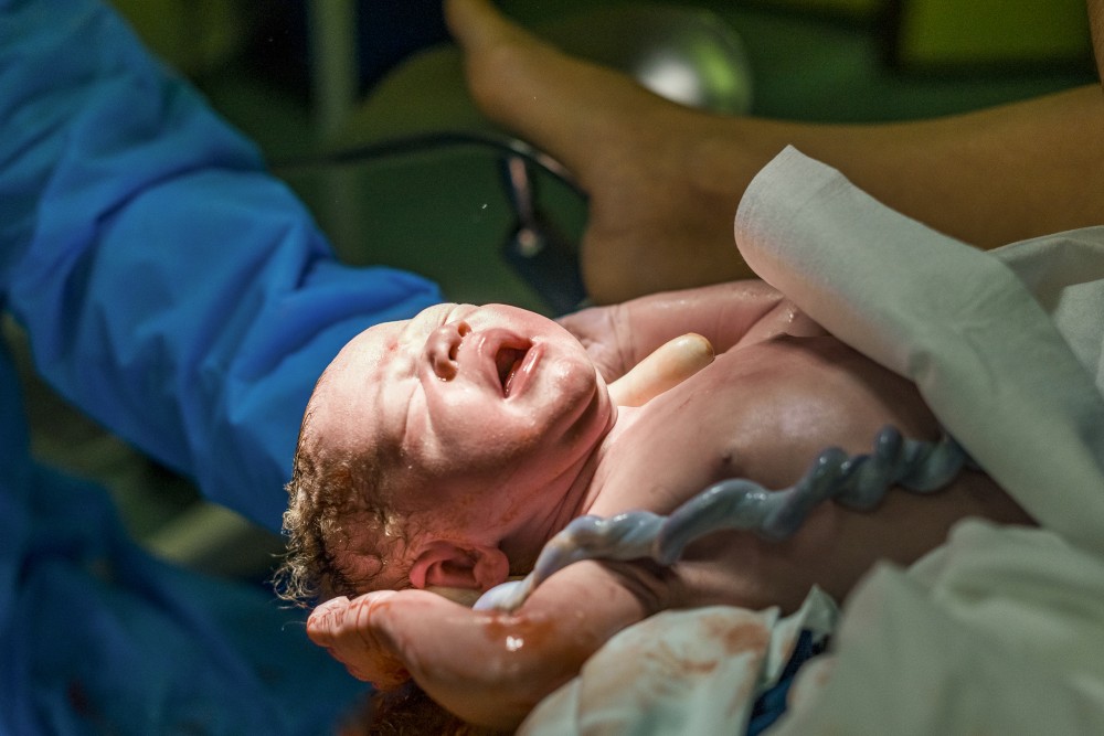 New born baby boy with umbilical cord assisted by midwife