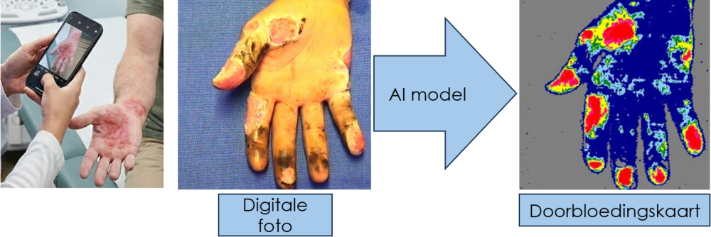 Van digitale foto naar doorbloedingskaart: het AI-model voorspelt op basis van een gewone foto (links) wat de dure laserscanner zou meten (rechts).